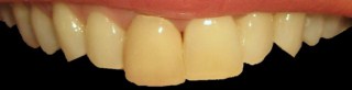 cosmetic dentistry glasgow smile before pic 3